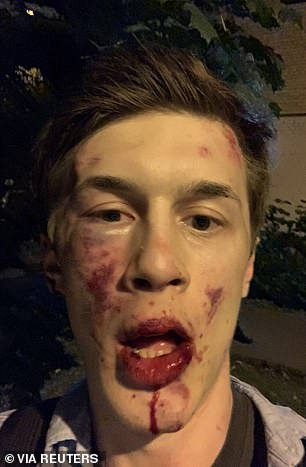 Russian opposition activist Yegor Zhukov was badly beaten outside his home in Moscow