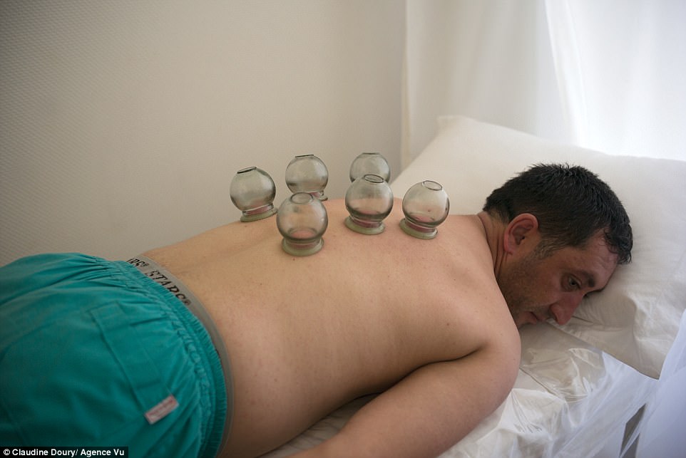 Cupping: A brave man in the Naftalan sanatorium tries the quirky therapy, which is said to relieve back and neck pains